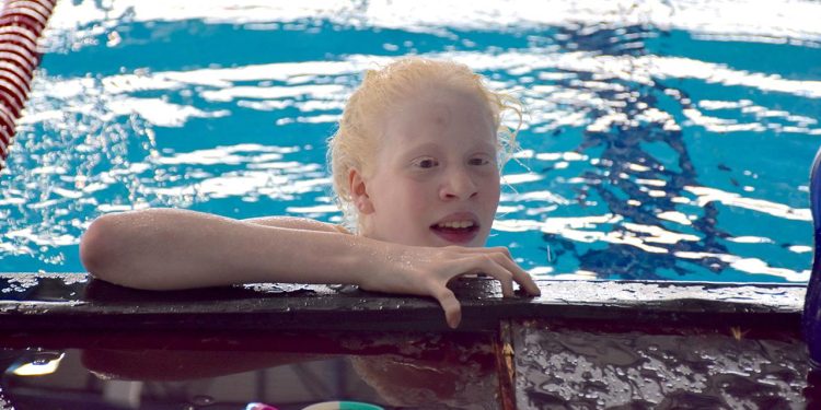 Albino yüzücü Ceren Yergezen’in hedefi Paralimpik Oyunları’na katılmak